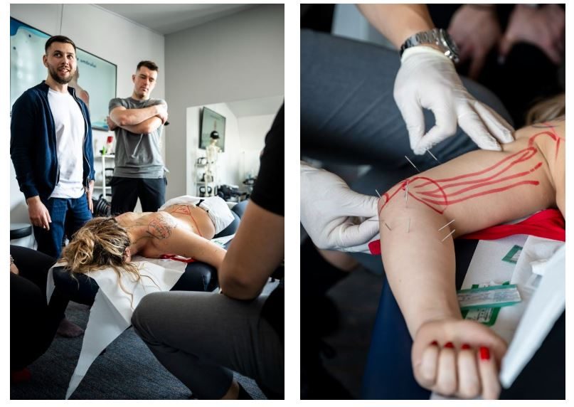 curs acupunctura musculara dry needling in bucuresti la medboost academy – aplicabil imediat in cabinet